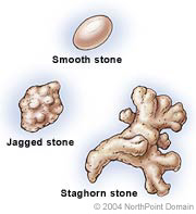 can dogs pass bladder stones